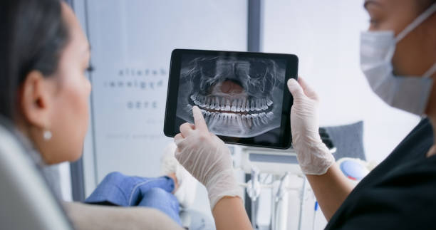 Licensed Tooth Extraction service in Locust Grove, GA - Smile Center Dentistry